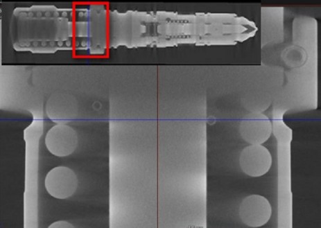 Computertomographieaufnahme Dieselinjektor -Motorschaden-Motorensachverständiger-Motorengutachter